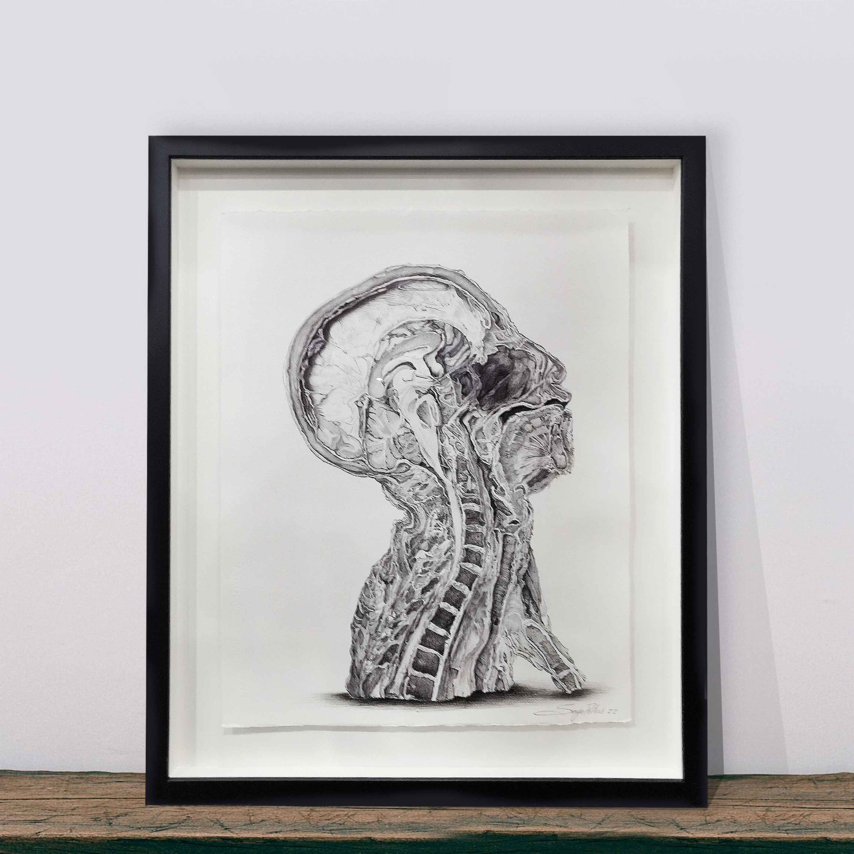 Sonya G. Peters’ Cadaver Museum Project